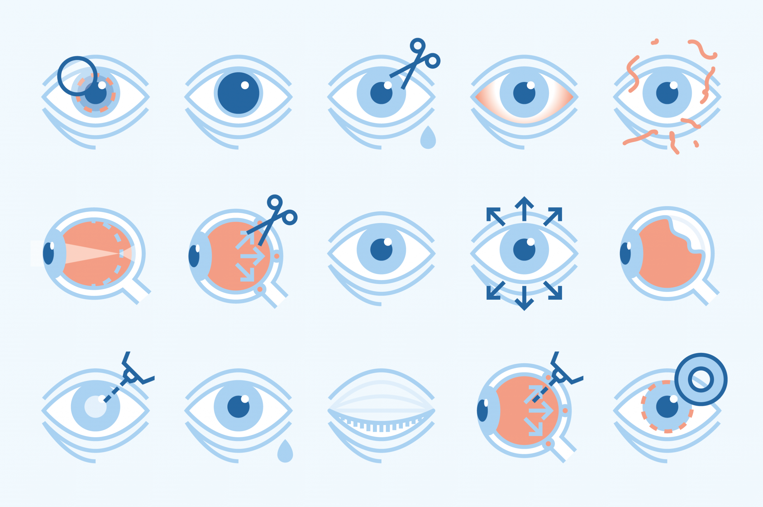 forma_barraquer_eyes_01B