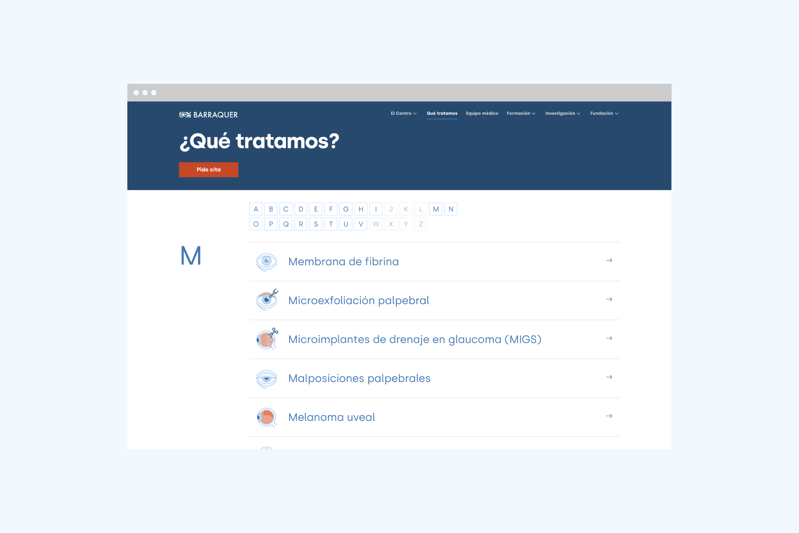 forma_barraquer_eyes_08