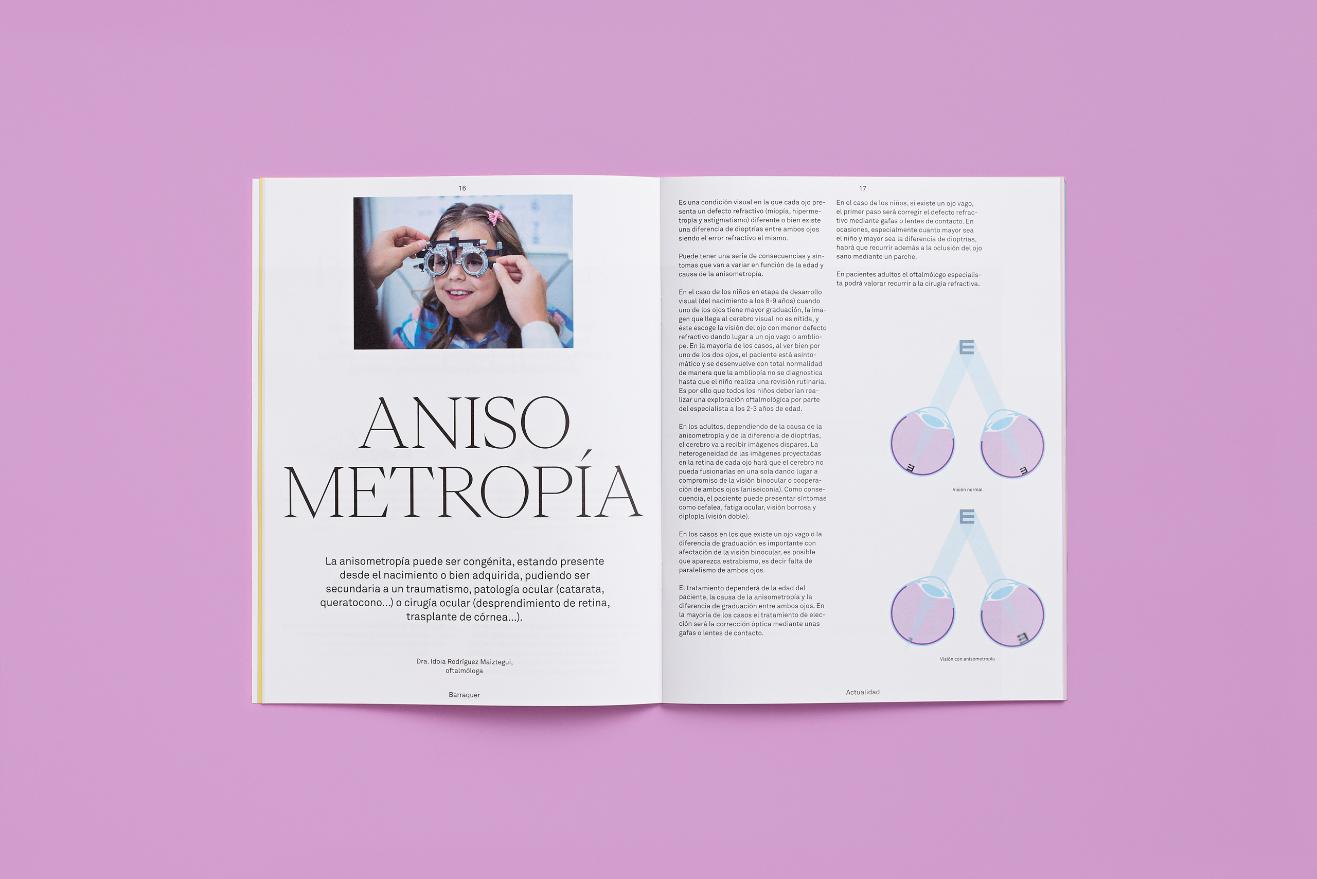 Forma_Barraquer_Revista_04